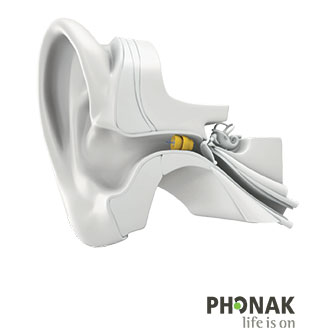 lyric-hearing-aid-phonak